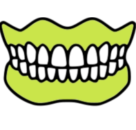 Implant-crowns bridges