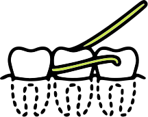 dental hygiene prevention